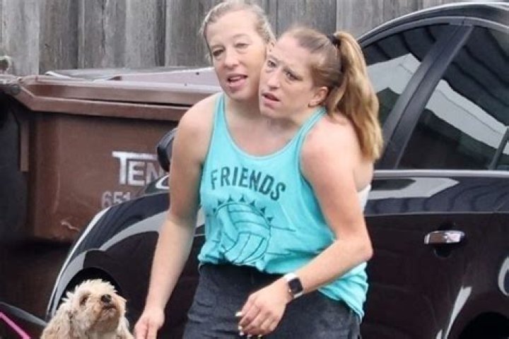 Abby and Brittany Hensel Sad News: Reflecting on a Remarkable Life