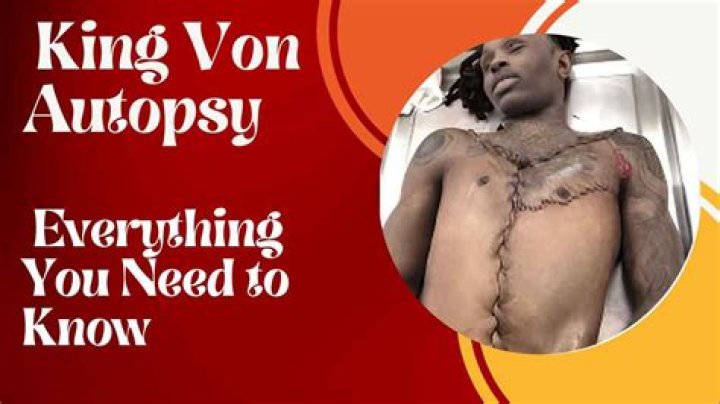 King Von Death Details: A Closer Look at What Happened